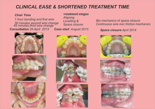 treatment-img