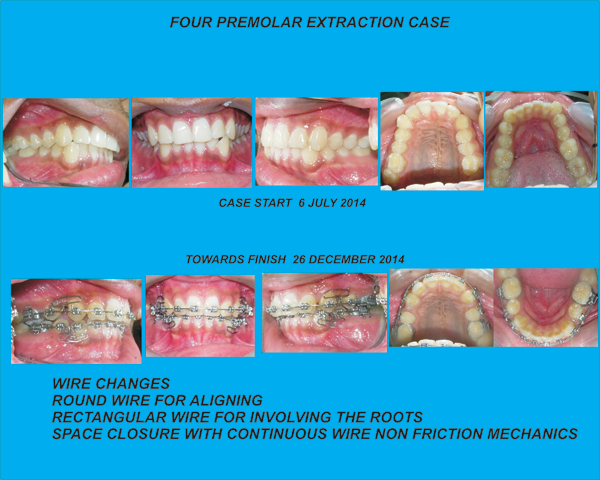 treatment-img